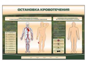 Электрифицированный стенд-тренажер "Остановка кровотечения"