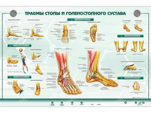 Интерактивный светодинамический стенд "Травмы стопы и голеностопного сустава"